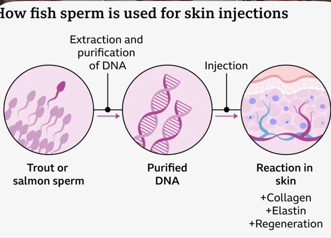 Move Over Fillers – Here’s Why People Are Having Facial Injections Made From Fish Sperm