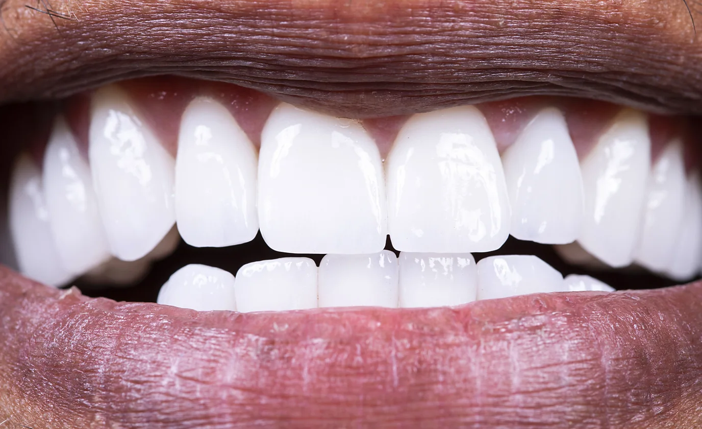 Here’s what To Eat To Protect Your Mouth’s Good Bacteria