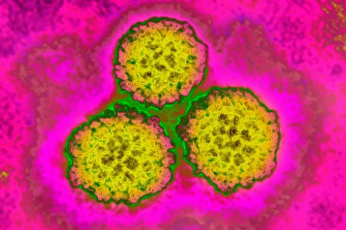 About 1 In 8 Cancer Cases Worldwide Are Tied To These Infections – Most Of Them Are Preventable